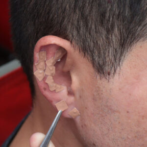 Terapia Auricular Kan Li 坎离耳针疗法