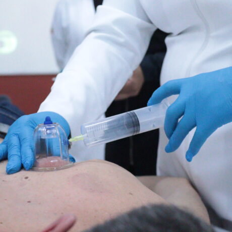 Profissional aplicando ozonioterapia em ponto de acupuntura no braço de um paciente, demonstrando a integração entre ozônio medicinal e Medicina Oriental.