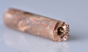 Descoberta de Agulhas de Acupuntura Mais Antigas do Mundo Revoluciona a História da Medicina Chinesa
